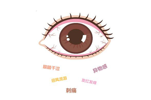 干眼症有哪些表现 干眼症有哪些表现