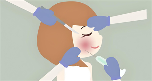 玻尿酸注射图 玻尿酸注射图