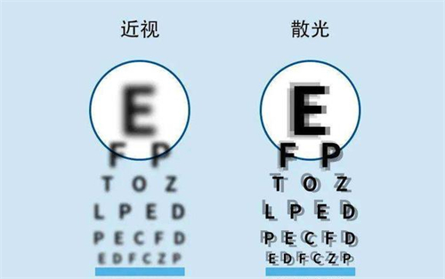 近视眼镜和散光的区别 近视眼镜和散光的区别