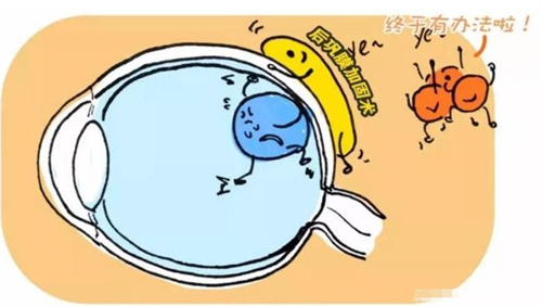 后巩膜加固术图片 后巩膜加固术图片