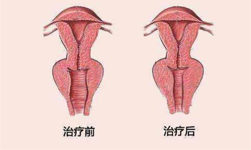 私密治疗对比图 私密治疗对比图