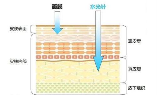 水光补水和面膜补水的区别 水光补水和面膜补水的区别