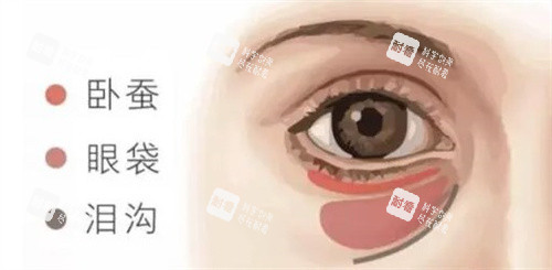 卧蚕眼袋泪沟的区别 卧蚕眼袋泪沟的区别