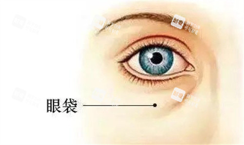 眼袋 眼袋