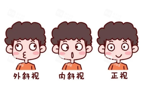 眼睛内斜视外斜视正常眼睛对比图 眼睛内斜视外斜视正常眼睛对比图