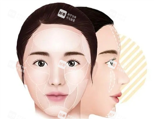 馒化脸需要修复部位图解 馒化脸需要修复部位图解