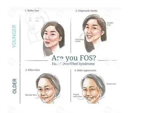 馒化脸示意图 馒化脸示意图