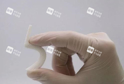 超体隆鼻照片展示图
