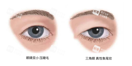 需要提眉的状况 需要提眉的状况