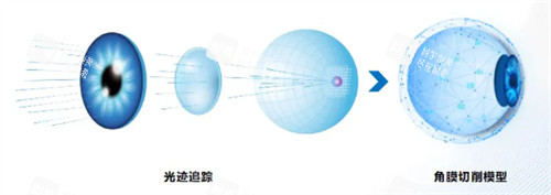 全光塑治疗模型 全光塑治疗模型