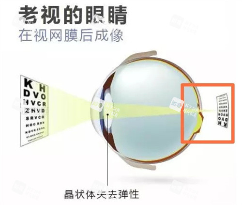 老花眼图片