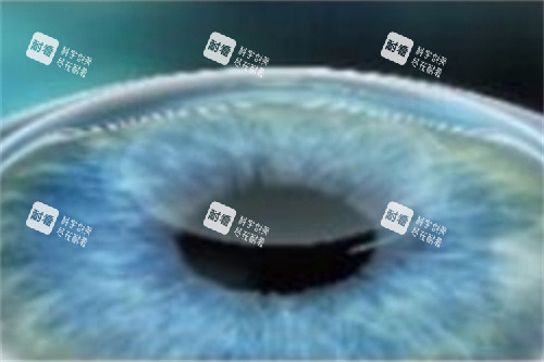 全飞秒透镜