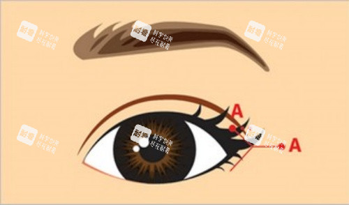 割眼角前设计图 割眼角前设计图