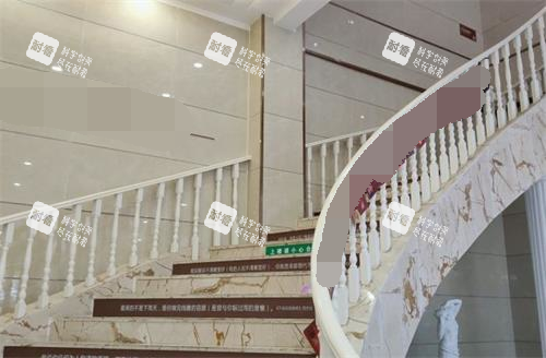 阜阳壹加壹医疗美容医院楼梯 阜阳壹加壹医疗美容医院楼梯