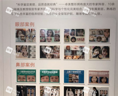 武汉硚口卓美整形展示墙 武汉硚口卓美整形展示墙