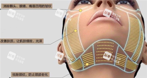 热玛吉皮肤作用细节图 热玛吉皮肤作用细节图