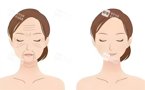 眼袋手术前后对动画图 眼袋手术前后对动画图