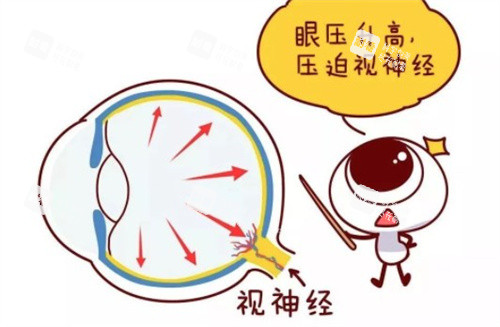 视神经压迫 视神经压迫