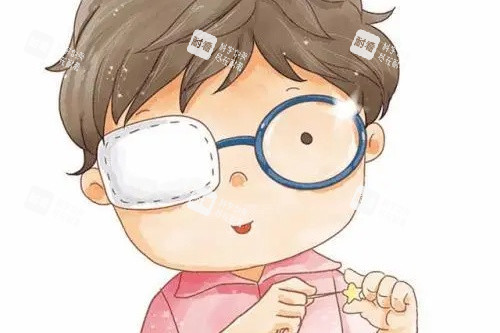 儿童斜视卡通图 儿童斜视卡通图
