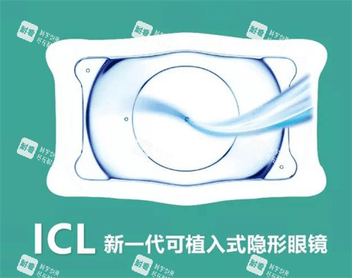 ICL晶体植入 ICL晶体植入