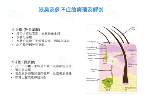 腋臭怎么办 腋臭怎么办