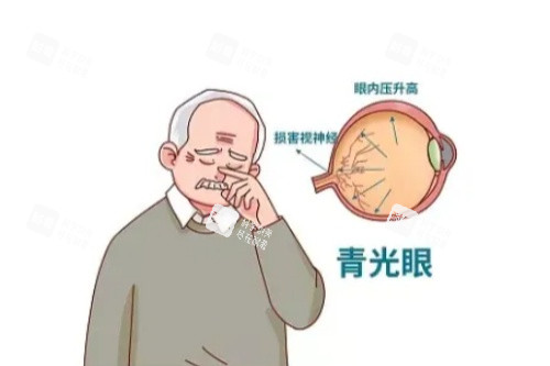 青光眼卡通一览图