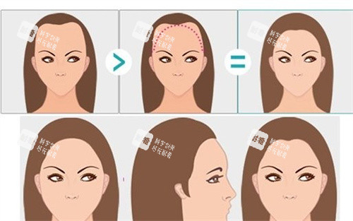 女性m型发际线卡通图