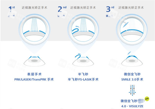 全飞秒4.0技术与其他技术对比 全飞秒4.0技术与其他技术对比