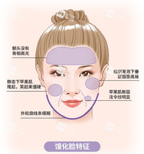 馒化脸怎么办 馒化脸怎么办