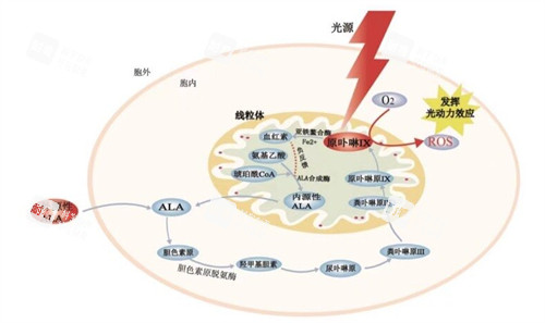 光动力治疗黄斑眼病原理图解