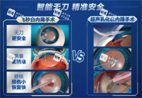 爱尔眼科白内障手术 爱尔眼科白内障手术