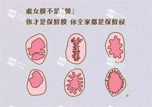 处女膜形状动画演示图