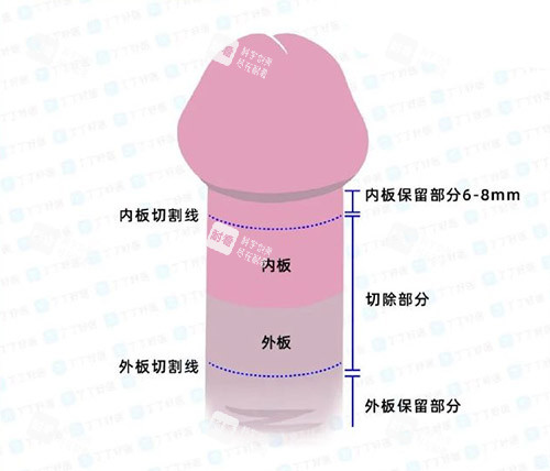 男性阴茎照片