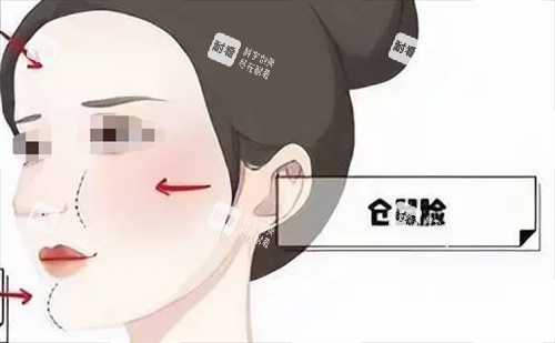 玻尿酸后馒化现象动画展示 玻尿酸后馒化现象动画展示