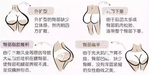 不完美的臀型 不完美的臀型