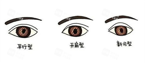 双眼皮 双眼皮