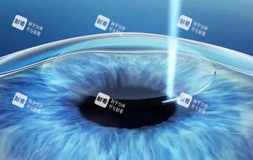 飞秒激光展示图