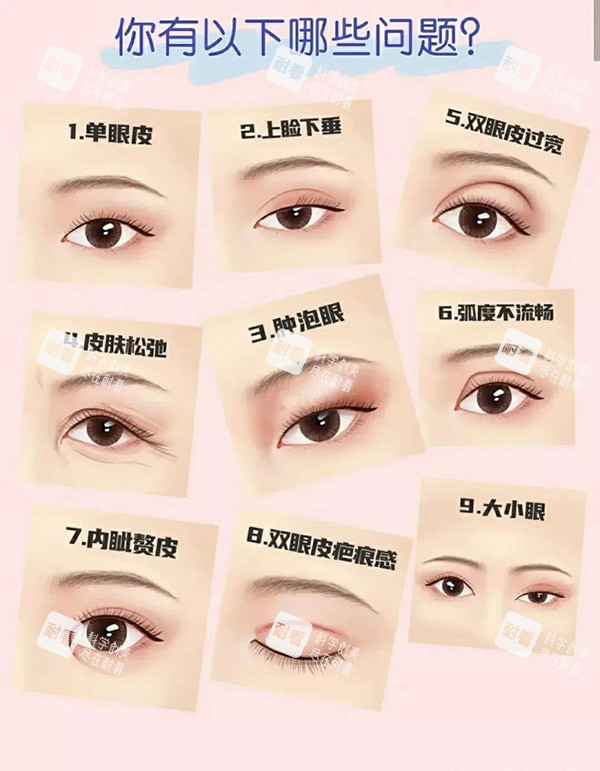 双眼皮类型图片 双眼皮类型图片