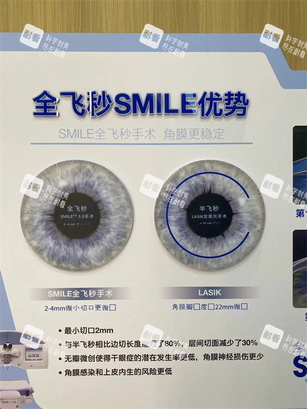 全飞秒SMILE优势 全飞秒SMILE优势