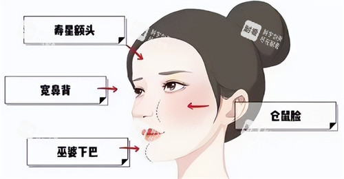 馒化脸 馒化脸