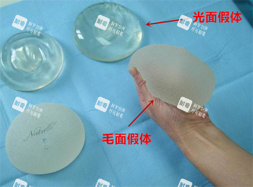 隆胸假体示意图.jpg