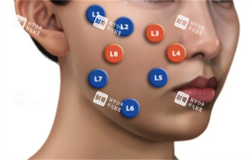 乔雅登不同点位注射方法.jpg 乔雅登不同点位注射方法.jpg