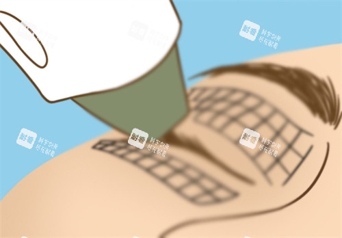 眼部热玛吉 眼部热玛吉