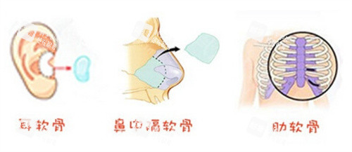 自体组织