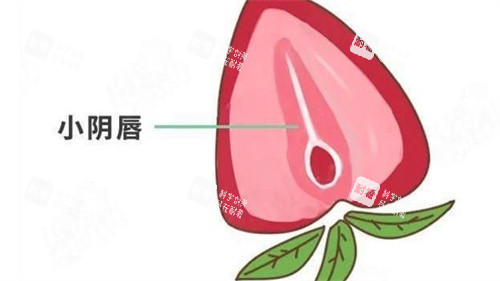 小阴唇整形 小阴唇整形