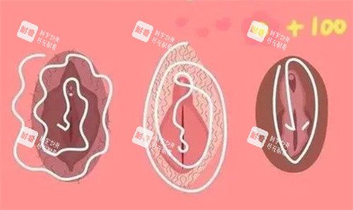 私密漂红卡通图 私密漂红卡通图