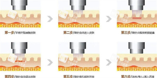 济州RA医院怎么样：With升级品牌+崔锡珉坐诊，超声提拉/XERF/丽珠兰套餐149万起