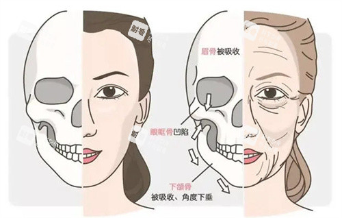 年轻和老化的面部骨骼.jpg