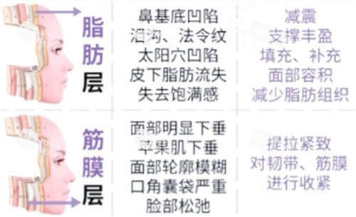 筋膜层抗衰重点.jpg 筋膜层抗衰重点.jpg