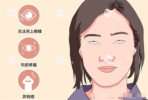需要做眼修复的情况.jpg